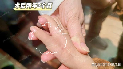 info-1242-699 info-1242-699